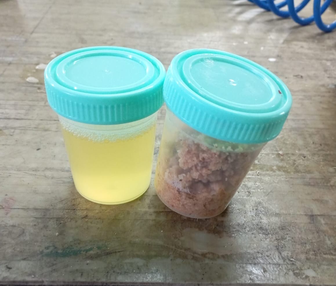 Ensayos de filtración 1